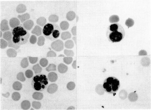 https://cdn.ncbi.nlm.nih.gov/pmc/blobs/5e07/1537775/767b890b4dfa/clinexpimmunol00204-0095-a.jpg