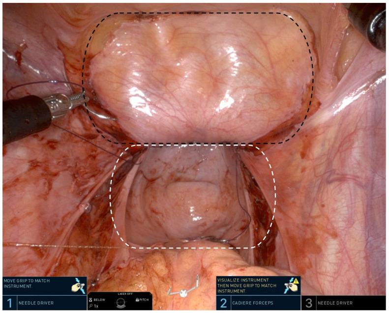 https://cdn.ncbi.nlm.nih.gov/pmc/blobs/5e0b/11122258/cfef6bbfa221/jcm-13-02760-g002.jpg