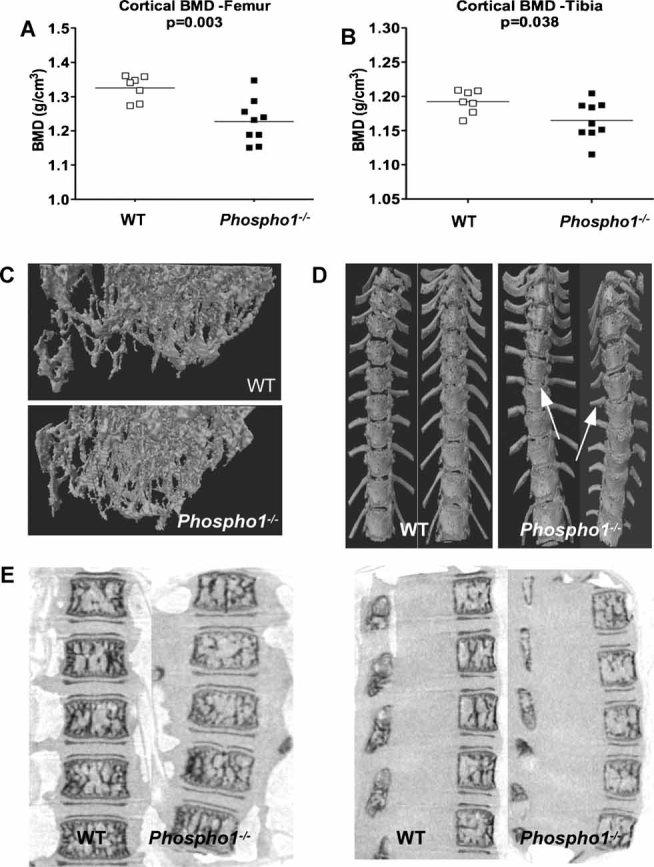 https://cdn.ncbi.nlm.nih.gov/pmc/blobs/5e19/3179344/fbff7a57eaf1/jbmr0026-0286-f3.jpg