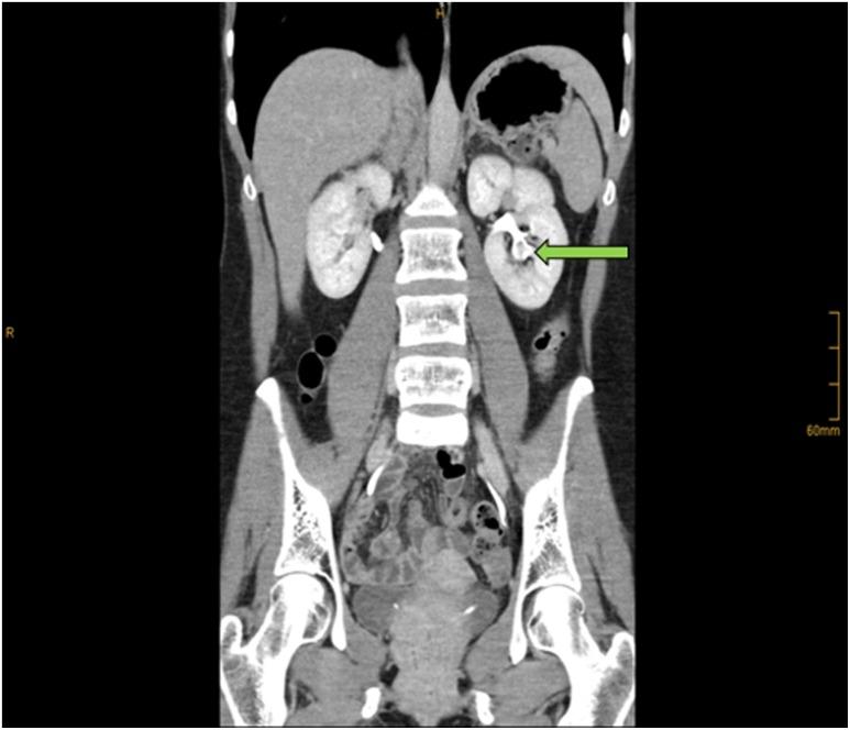 https://cdn.ncbi.nlm.nih.gov/pmc/blobs/5e19/6151332/a17b74dd66a9/fig-1.jpg