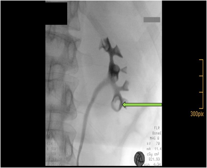 https://cdn.ncbi.nlm.nih.gov/pmc/blobs/5e19/6151332/a7ffaf1d2357/fig-2.jpg