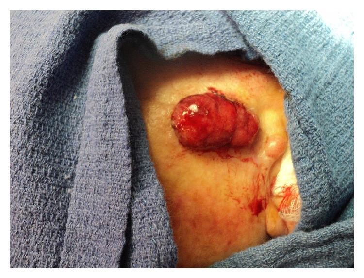 https://cdn.ncbi.nlm.nih.gov/pmc/blobs/5e20/4320911/4e59b83fdd17/CRIONM2015-534176.003.jpg