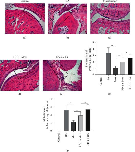 https://cdn.ncbi.nlm.nih.gov/pmc/blobs/5e24/11407876/3ebfd49a0302/ECAM2021-6658946.005.jpg