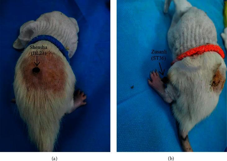 https://cdn.ncbi.nlm.nih.gov/pmc/blobs/5e24/11407876/b527c2a20d18/ECAM2021-6658946.001.jpg