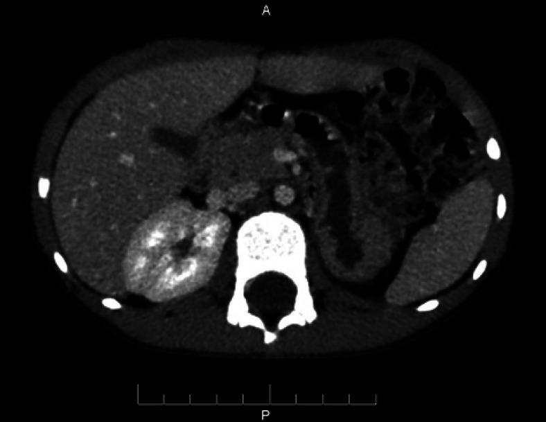 https://cdn.ncbi.nlm.nih.gov/pmc/blobs/5e28/8255719/0b23c30faa4f/cnd-0011-0124-g02.jpg