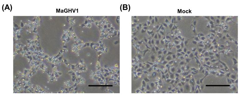 https://cdn.ncbi.nlm.nih.gov/pmc/blobs/5e2c/10303238/fc2079311ba6/viruses-15-01369-g002.jpg