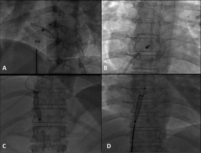 https://cdn.ncbi.nlm.nih.gov/pmc/blobs/5e2e/5598121/7ff2d6333277/imas-09-01-42_f002.jpg