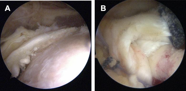 https://cdn.ncbi.nlm.nih.gov/pmc/blobs/5e35/7747109/7624c4a73f6b/10.1177_2325967120969213-fig2.jpg