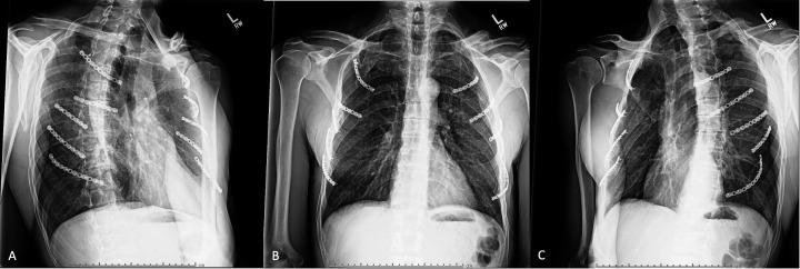 https://cdn.ncbi.nlm.nih.gov/pmc/blobs/5e39/12121575/76c7ca2a572f/tsaco-10-2-g001.jpg