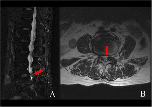 https://cdn.ncbi.nlm.nih.gov/pmc/blobs/5e3d/7429717/b8f8868f4eb2/12891_2020_3566_Fig1_HTML.jpg