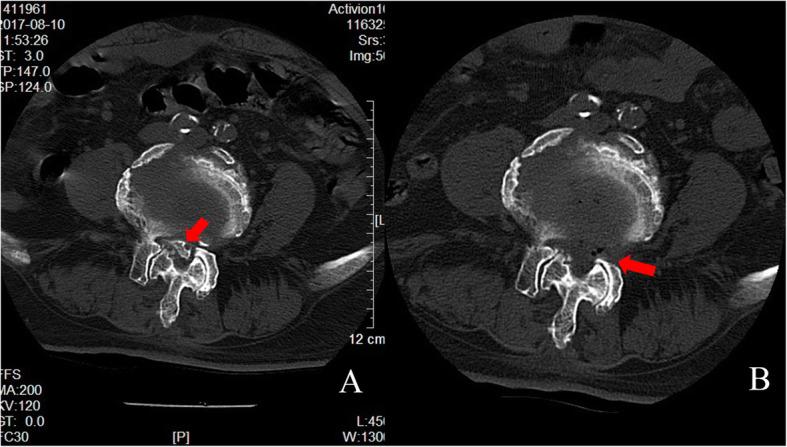 https://cdn.ncbi.nlm.nih.gov/pmc/blobs/5e3d/7429717/ca7659d5c5c9/12891_2020_3566_Fig2_HTML.jpg