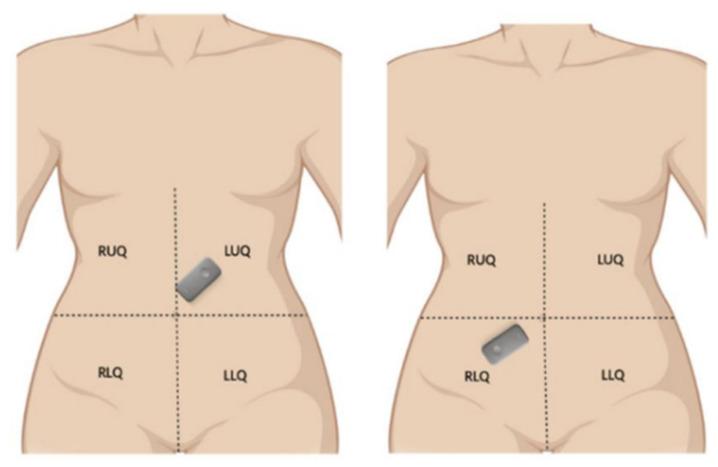 https://cdn.ncbi.nlm.nih.gov/pmc/blobs/5e45/12349269/25053b24fc80/sensors-25-04735-g001.jpg