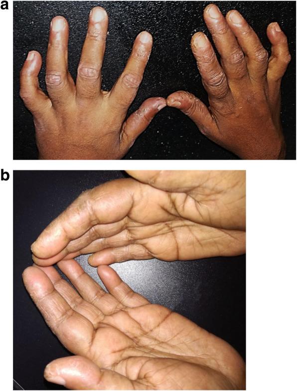 https://cdn.ncbi.nlm.nih.gov/pmc/blobs/5e48/8311943/0af735fa78c1/41927_2021_195_Fig2_HTML.jpg