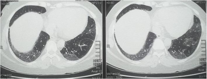 https://cdn.ncbi.nlm.nih.gov/pmc/blobs/5e48/8311943/6f1dfadb60bd/41927_2021_195_Fig1_HTML.jpg