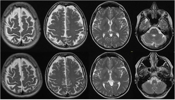 https://cdn.ncbi.nlm.nih.gov/pmc/blobs/5e4b/4895894/7a37e38c80f4/12888_2016_897_Fig1_HTML.jpg