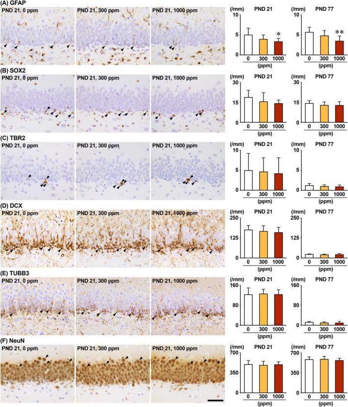 https://cdn.ncbi.nlm.nih.gov/pmc/blobs/5e53/11628657/29541012c0ab/TOX-40-30-g006.jpg