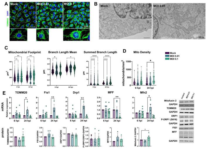 https://cdn.ncbi.nlm.nih.gov/pmc/blobs/5e54/10056985/b5d01fa5e04e/viruses-15-00745-g005.jpg