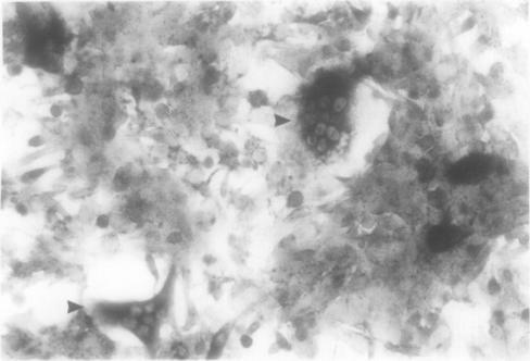 https://cdn.ncbi.nlm.nih.gov/pmc/blobs/5e55/500074/17a0add0b45a/jclinpath00256-0072-b.jpg