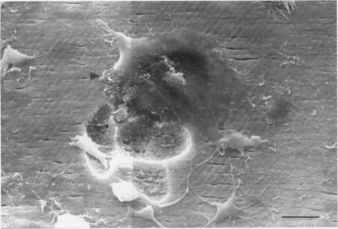 https://cdn.ncbi.nlm.nih.gov/pmc/blobs/5e55/500074/7d6e06125233/jclinpath00256-0073-b.jpg