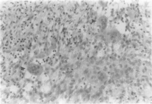 https://cdn.ncbi.nlm.nih.gov/pmc/blobs/5e55/500074/8f50d7d20be6/jclinpath00256-0072-a.jpg