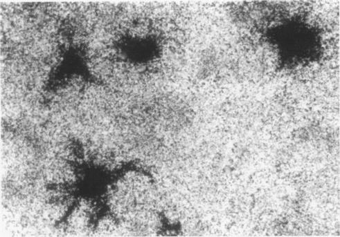 https://cdn.ncbi.nlm.nih.gov/pmc/blobs/5e55/500074/e88c19213c31/jclinpath00256-0073-a.jpg