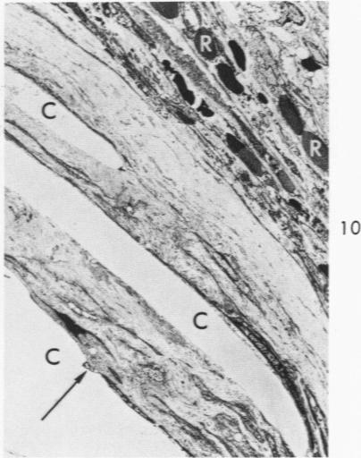 https://cdn.ncbi.nlm.nih.gov/pmc/blobs/5e56/1912470/633047f2db01/amjpathol00465-0111-d.jpg