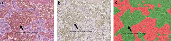 https://cdn.ncbi.nlm.nih.gov/pmc/blobs/5e59/7685215/faf13fb7e754/fendo-10-587779-g001.jpg