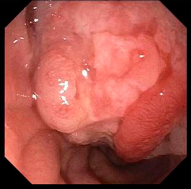 https://cdn.ncbi.nlm.nih.gov/pmc/blobs/5e5d/11567703/6e89a2da3db6/ac9-11-e01550-g002.jpg