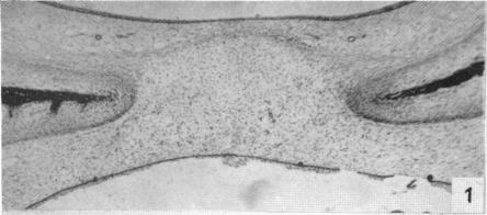 https://cdn.ncbi.nlm.nih.gov/pmc/blobs/5e5f/1244823/0977db14ddf6/janat00455-0100-a.jpg