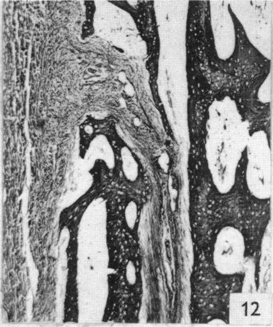 https://cdn.ncbi.nlm.nih.gov/pmc/blobs/5e5f/1244823/557078fb4540/janat00455-0101-b.jpg