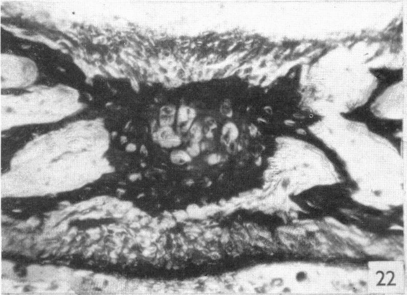 https://cdn.ncbi.nlm.nih.gov/pmc/blobs/5e5f/1244823/978f601e54e3/janat00455-0102-e.jpg