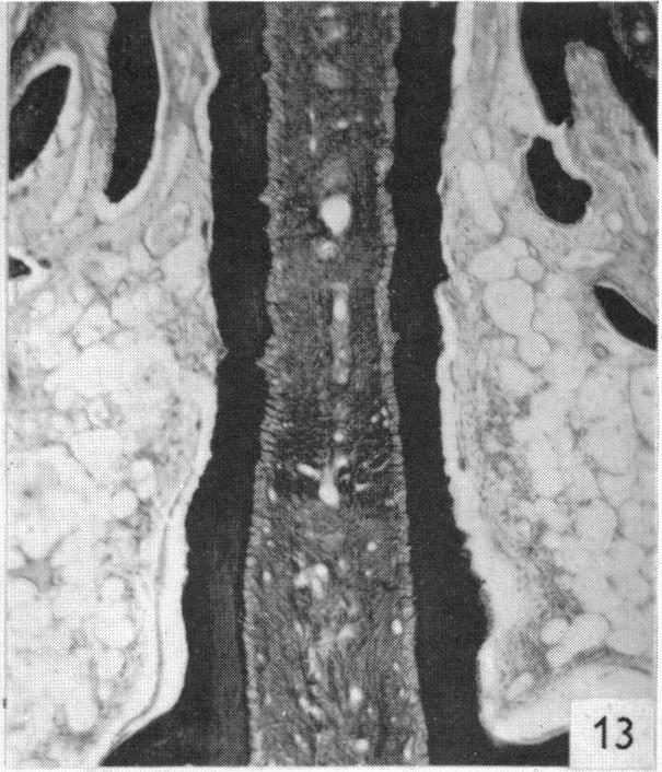 https://cdn.ncbi.nlm.nih.gov/pmc/blobs/5e5f/1244823/cc40a0873bb2/janat00455-0101-c.jpg
