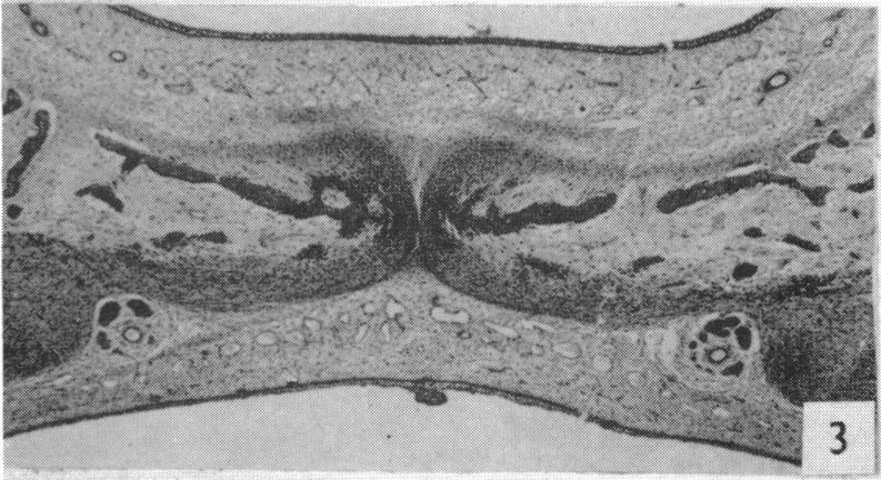 https://cdn.ncbi.nlm.nih.gov/pmc/blobs/5e5f/1244823/faad59f2d33d/janat00455-0100-c.jpg