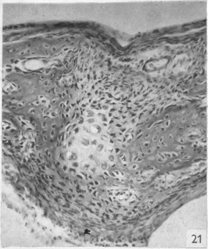 https://cdn.ncbi.nlm.nih.gov/pmc/blobs/5e5f/1244823/fdb672e07107/janat00455-0102-d.jpg