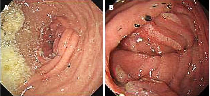 https://cdn.ncbi.nlm.nih.gov/pmc/blobs/5e66/7445872/d337e9c07c1c/WJG-26-4669-g006.jpg