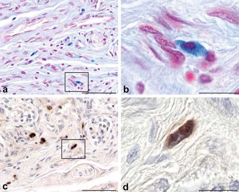 https://cdn.ncbi.nlm.nih.gov/pmc/blobs/5e6a/10038025/d2c1abf4d057/KPRN_A_2193128_F0002_OC.jpg