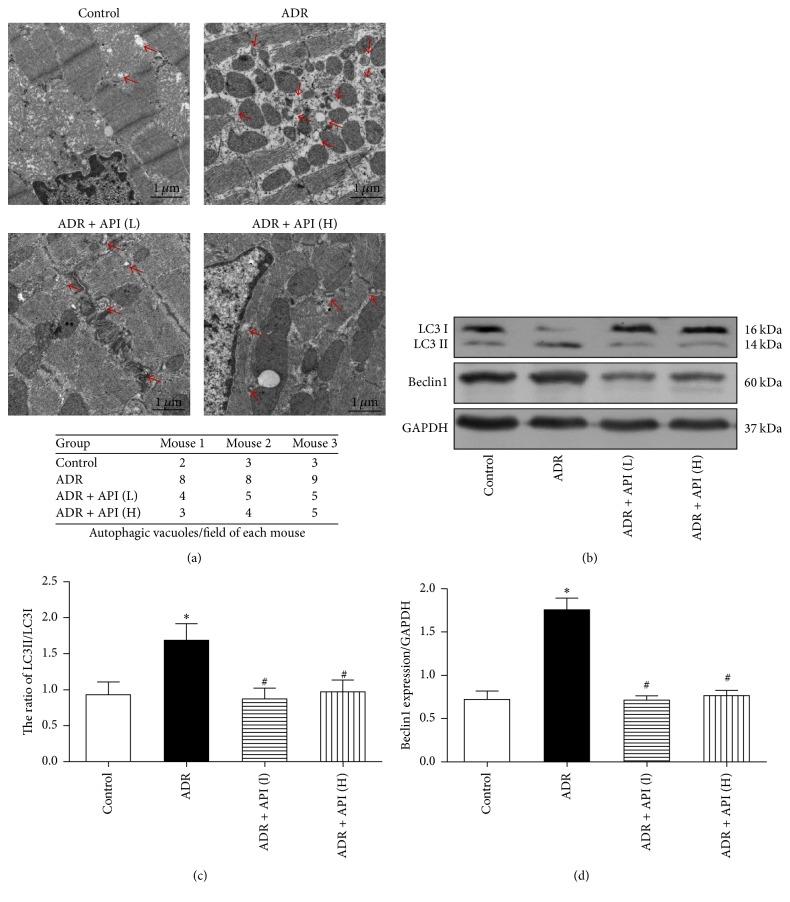 https://cdn.ncbi.nlm.nih.gov/pmc/blobs/5e6f/5480054/d668854adf81/ECAM2017-2590676.003.jpg