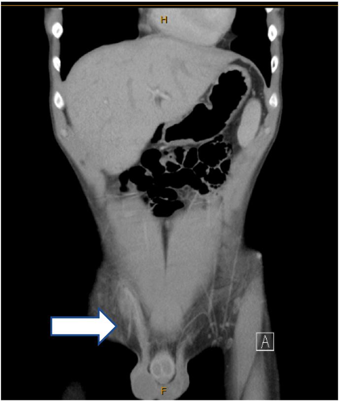 https://cdn.ncbi.nlm.nih.gov/pmc/blobs/5e71/9065614/d749965a9f83/gr2.jpg