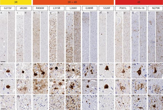 https://cdn.ncbi.nlm.nih.gov/pmc/blobs/5e73/9995405/f334f7e31591/401_2022_2487_Fig1_HTML.jpg
