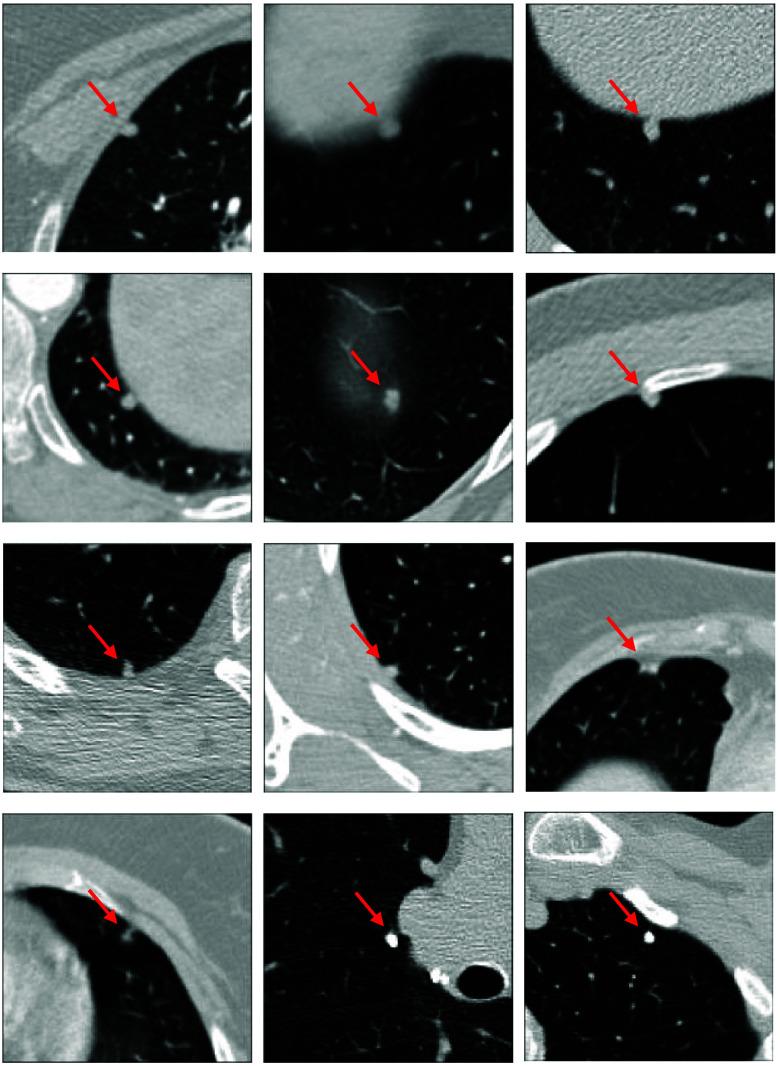 https://cdn.ncbi.nlm.nih.gov/pmc/blobs/5e78/11304989/caa33ac28aca/JMI-011-044507-g008.jpg