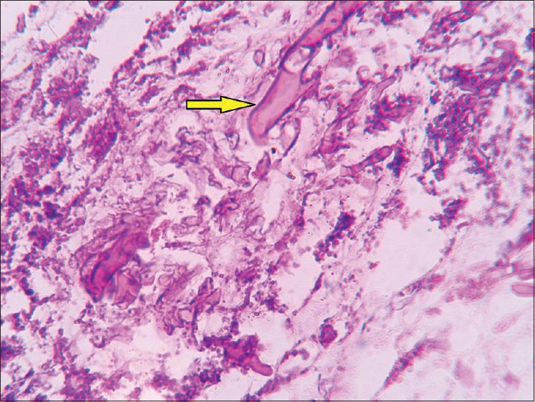 https://cdn.ncbi.nlm.nih.gov/pmc/blobs/5e7a/8083449/3704c0a1e834/JOMFP-24-558-g006.jpg