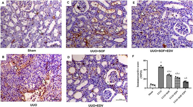 https://cdn.ncbi.nlm.nih.gov/pmc/blobs/5e7e/11522075/74b1f93ee1ee/210_2024_3146_Fig8_HTML.jpg