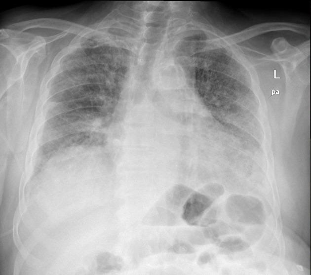 https://cdn.ncbi.nlm.nih.gov/pmc/blobs/5e81/11809608/3475c53295b2/jmc-16-069-g002.jpg