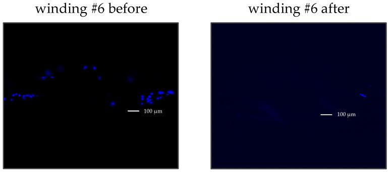 https://cdn.ncbi.nlm.nih.gov/pmc/blobs/5e88/12345868/2f2a432d82bb/diagnostics-15-01876-g005.jpg