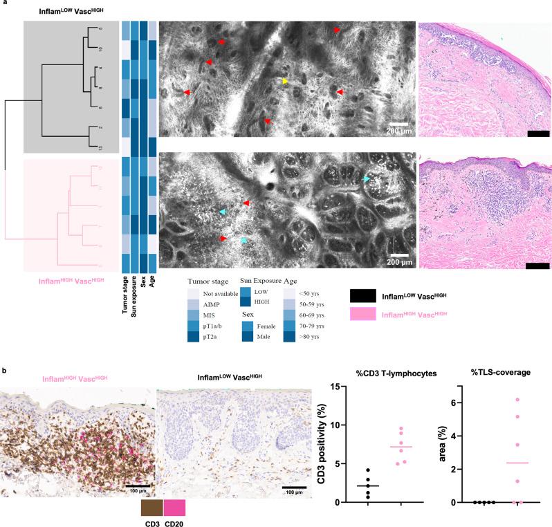 https://cdn.ncbi.nlm.nih.gov/pmc/blobs/5e8a/9463451/9b5931375c2b/41467_2022_32738_Fig5_HTML.jpg