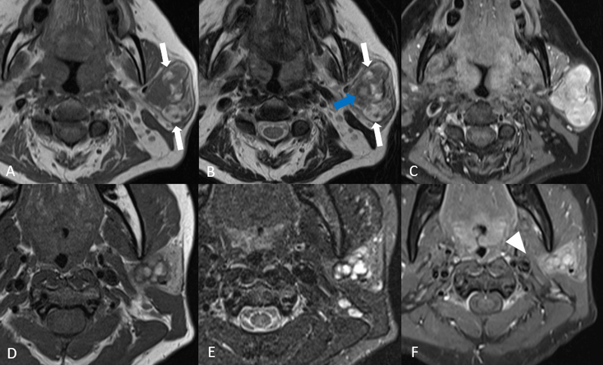https://cdn.ncbi.nlm.nih.gov/pmc/blobs/5e91/9641923/0bfcaa75dadb/12880_2022_924_Fig7_HTML.jpg
