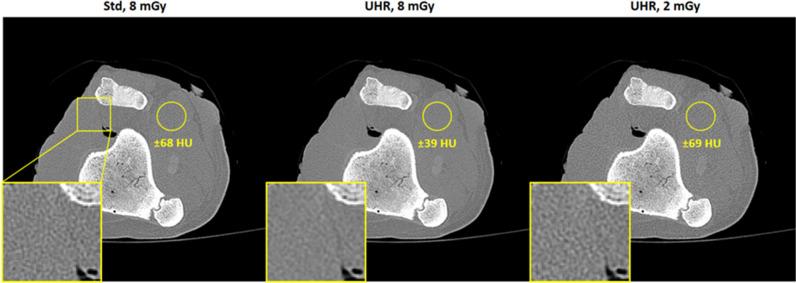 https://cdn.ncbi.nlm.nih.gov/pmc/blobs/5e94/11213748/9eb4075b5961/330_2023_10499_Fig5_HTML.jpg