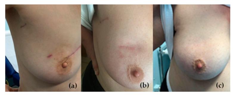 https://cdn.ncbi.nlm.nih.gov/pmc/blobs/5e94/8534590/cac0d5030e2f/curroncol-28-00335-g001.jpg
