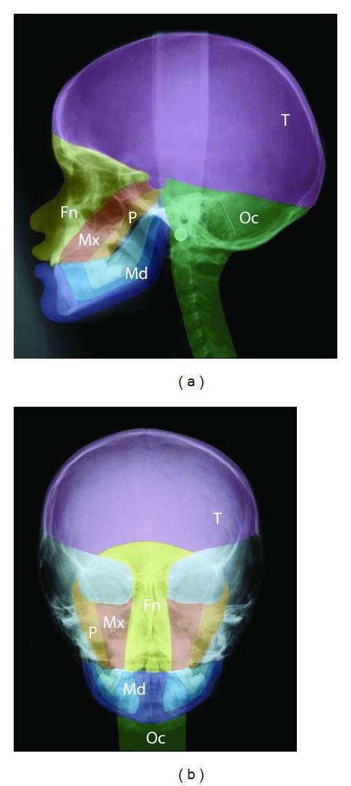 https://cdn.ncbi.nlm.nih.gov/pmc/blobs/5e95/3467949/9865a4d254bf/IJD2012-145749.002.jpg