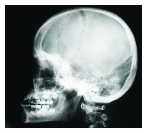https://cdn.ncbi.nlm.nih.gov/pmc/blobs/5e95/3467949/fbf4978fc86a/IJD2012-145749.011.jpg